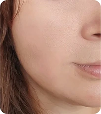 After woman