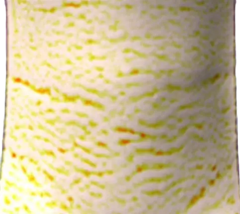 Antera 3d after