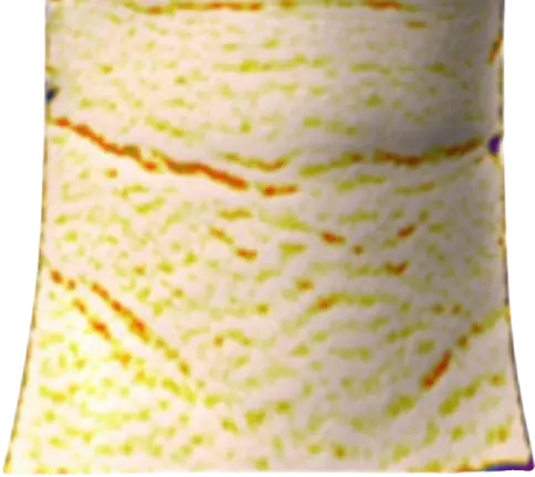 Antera 3d before