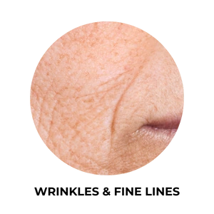 Plushderm_Fine-lines-wrinkles