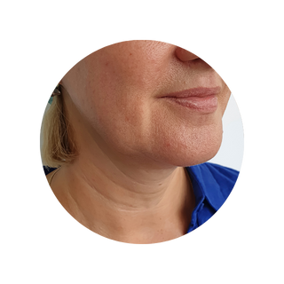 Plushderm reduces fine lines hq