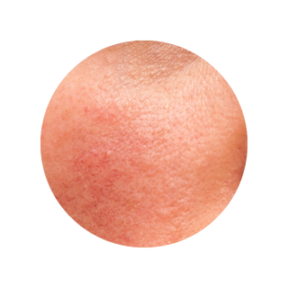 Plushderm reduces inflammation hq