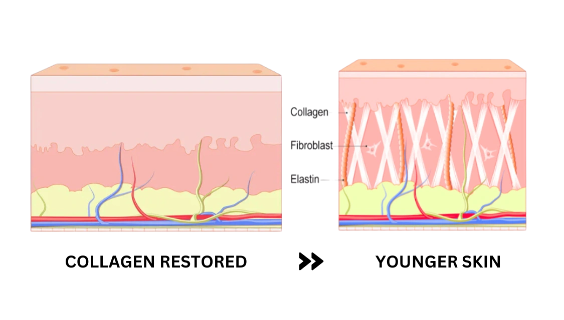 Plushderm rejuvenates skin